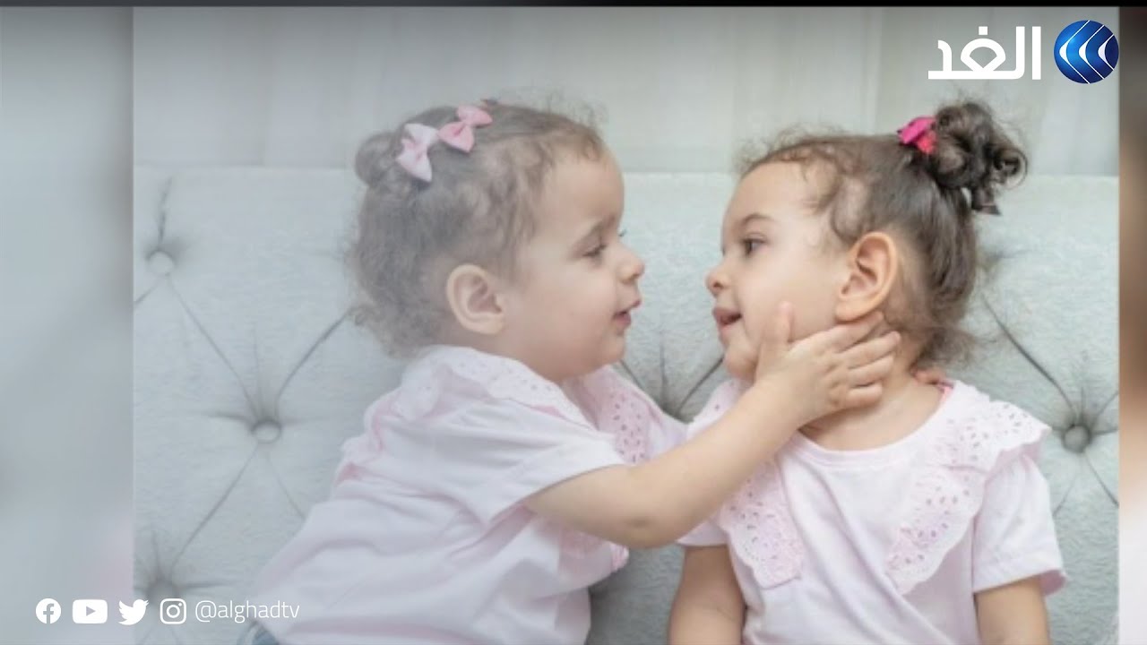 جهود مصرية لجمع ملايين الدولارات لعلاج الأطفال من مرضى ضمور العضلات