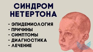 Синдром Нетертона: эпидемиология, причины, симптомы, диагностика и лечение