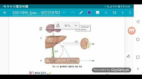 9 1 간, 담낭, 췌장 질환자 간호