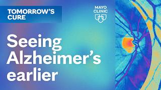 A Window Into the Brain: Retinal Imaging and Alzheimer's | Tomorrow's Cure Season 5 Episode 2
