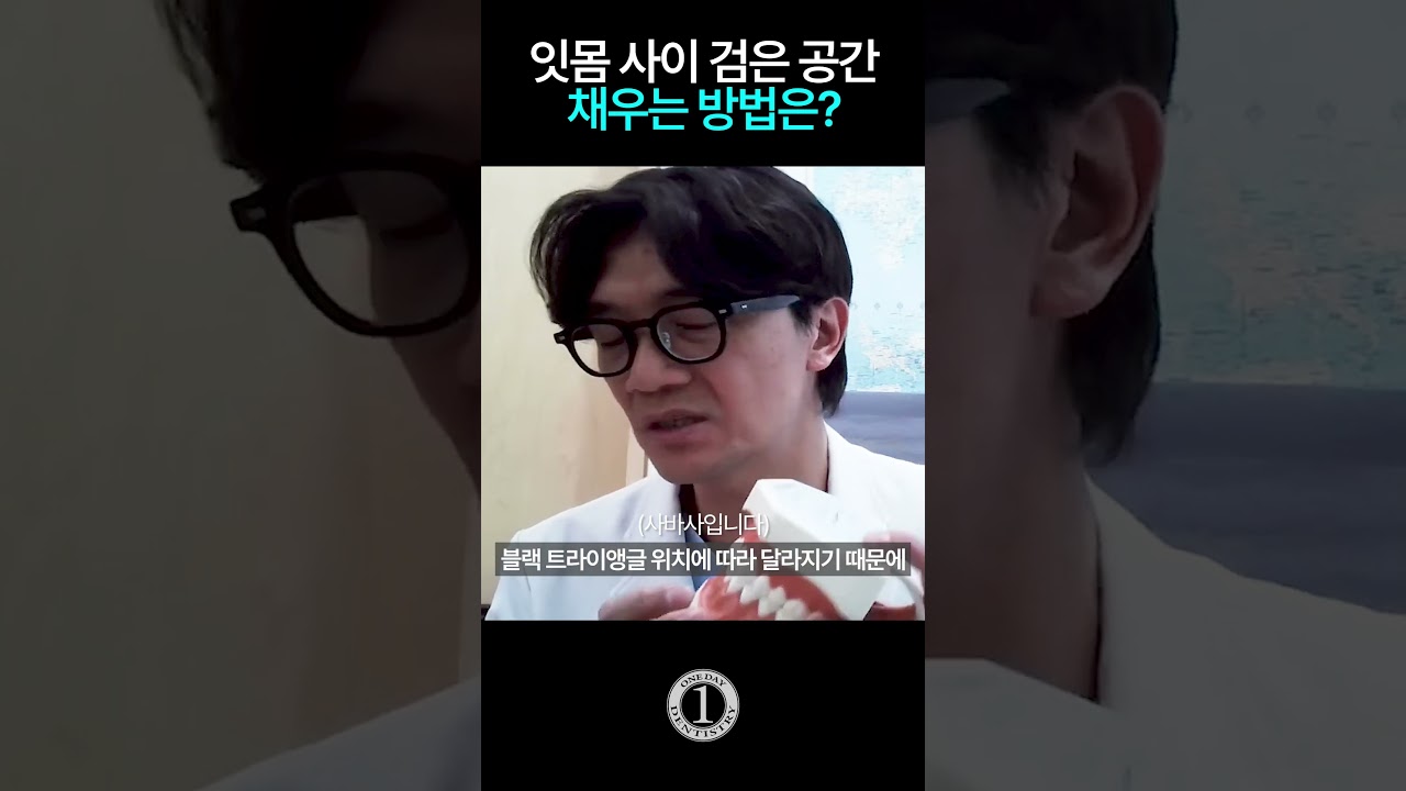 [一日牙科診所] 黑色三角形的實際解決方法