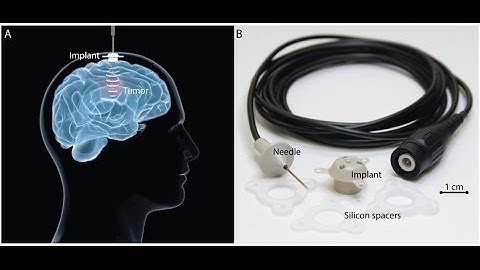 Bubbles could help get medicines into your brain