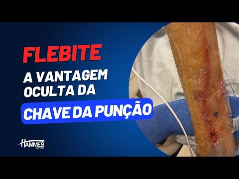 Vídeo: Quanto ganha um infusionista?