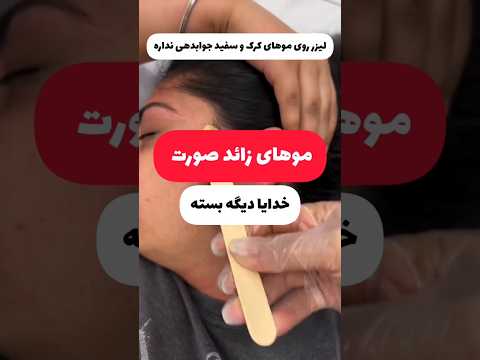 رفع مو زائد صورت با این ترفند عالی امکانپذیره موهای کرک و سفید صورت با لیزر نمیرن آموزش