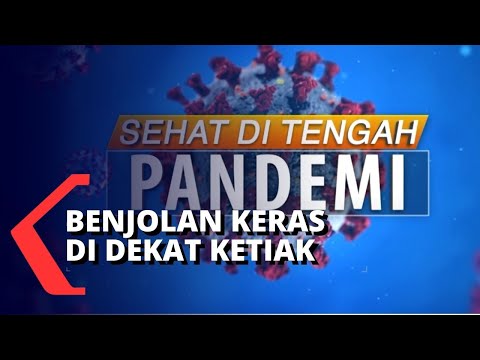 Video: Boil Under Arm: Penyebab Dan Gejala Bisul Ketiak