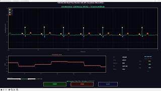 VSH101 ECG Real-Time Monitor with QTc Calculation (NeuroKit2)