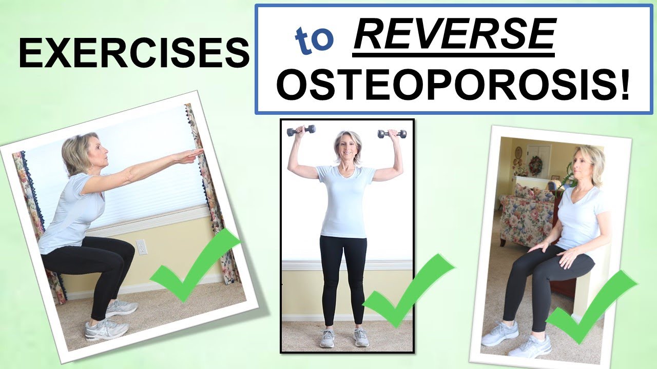 Reversing Osteoporosis Naturally Through Exercise Best Exercises To reversing-osteoporosis-naturally-through-exercise-best-exercises-to