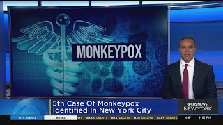 5th case of monkeypox identified in New York City