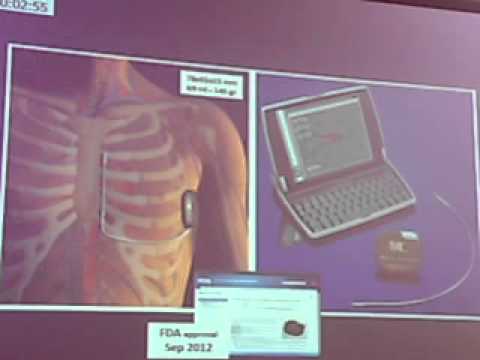 ESC 2014 CRM devices :Steadly evolving field by Prof . Panas Vardas cardiologue bourgoin