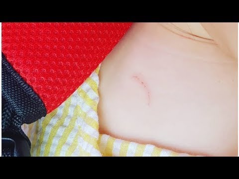 정가은 "딸 몸에 꼬집은 상처가 3군데..속상해요"