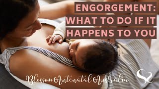 Engorgement What To Do If It Happens To You