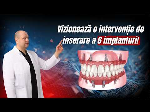 Vizionează o intervenție de inserare a 6 implanturi!!