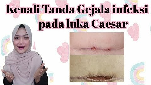 Tanda jahitan caesar bagian dalam sudah kering