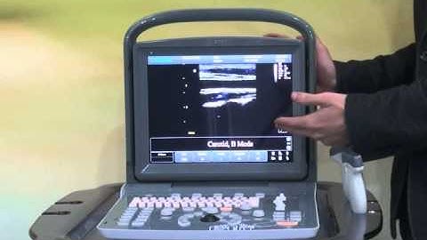 CHISON ECO Product Intraduction 1