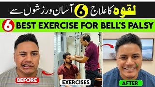 Execises for Facial Palsy Recovery | Exercises for Bell's Palsy Recovery|Exercises for Face  Muscles