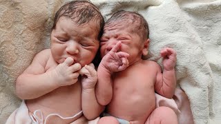 Chubby Twins  Newborn babies with the cutest first Cry immediately after birth