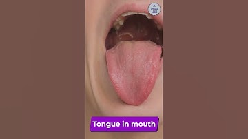 Can You Identify These Objects? Test Your Microscopic Observation Skills with This Exciting Quiz!