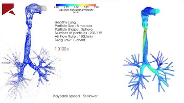 Fine particles in human airway simulation using Rocky DEM