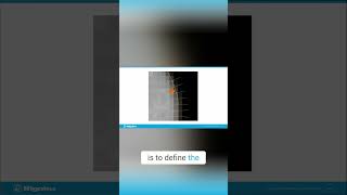 Surface Metrology Precise Analysis with Probe Data