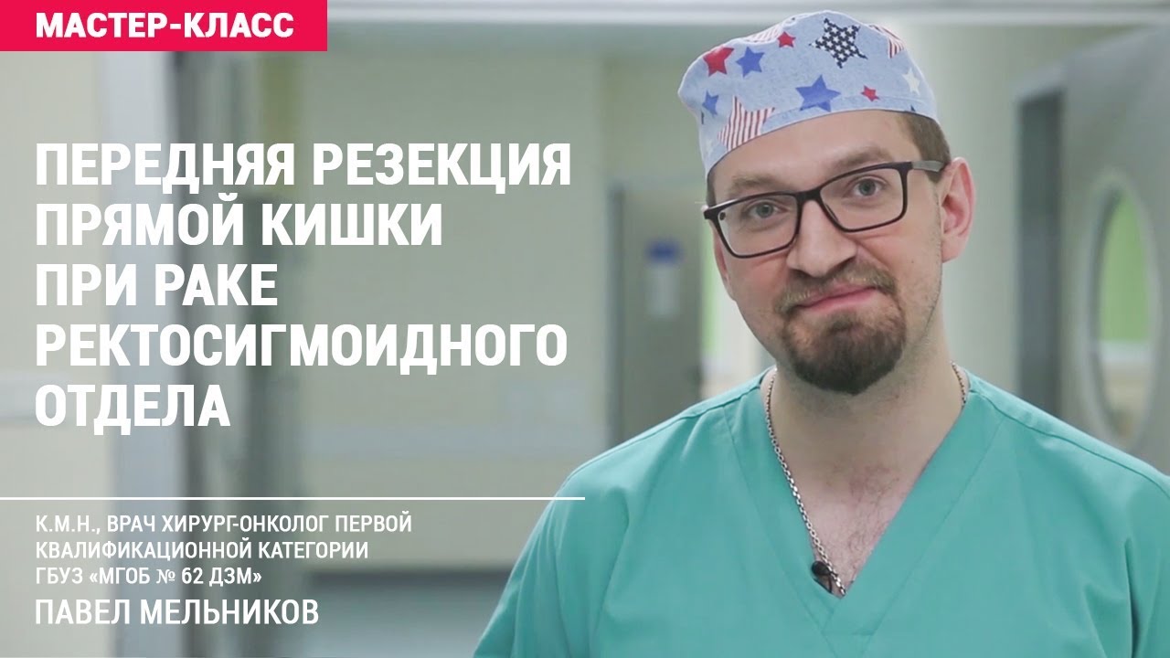 Передняя резекция прямой кишки при раке ректосигмоидного отдела