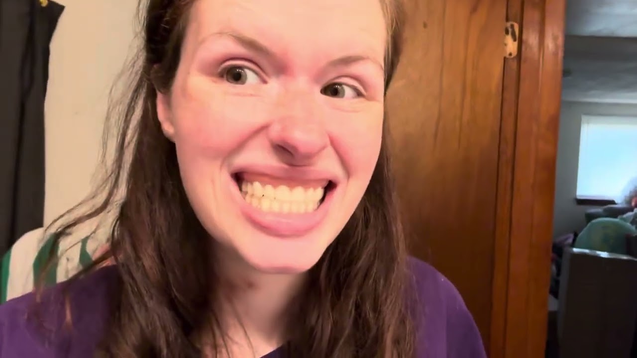 Месяц после операции | Всё ещё ем мягкую пищу, всё ещё без зубных протезов, скоро приём у стомато...