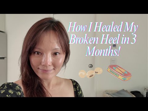 Here’s What I Ate After ORIF Surgery | Healing Calcaneus