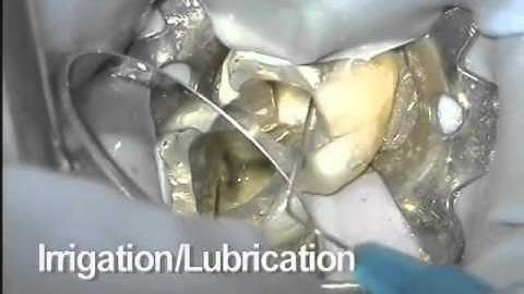 ProTaper Universal Access & Shaping | Dentsply Sirona