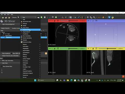 Masking segmentation with grayscale image - 3D Slicer Tutorial