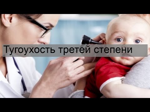 Тугоухость третей степени