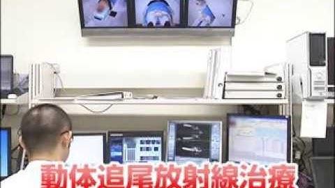 動体追尾放射線治療器紹介