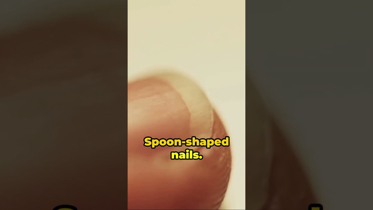 Toenails The Unexpected Health Indicators