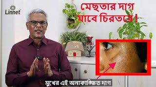 মেছতার দাগ মুছে ফেলার জন্য ৭টি ঘরোয়া উপায় যা আপনি চেষ্টা করতে পারেন screenshot 3
