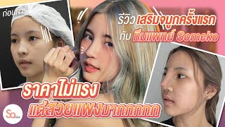 รีวิวจมูกแท่งแรกในชีวิต แก้ปัญหาเนื้อน้อย ปลายทู่กับทีมแพทย์ Someko