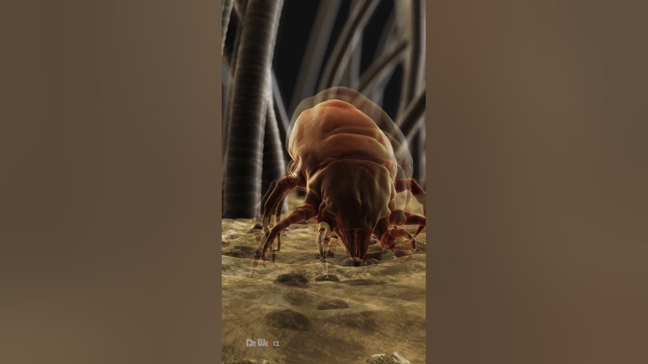 Scalp Infested With Head Lice