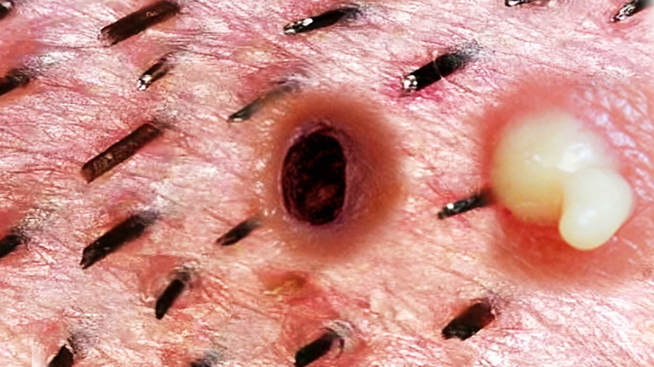 Related image