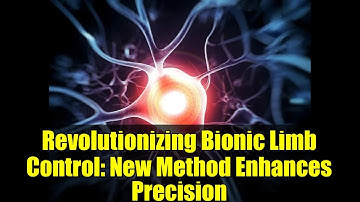 Revolutionizing Bionic Limb Control: New Method Enhances Precision