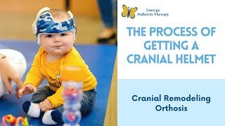 The Process Of Getting a Cranial Helmet (Cranial Remodeling Orthosis)