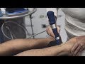 Radial Shockwave Therapy for Achilles Tendinopathy -  Physio Athletica