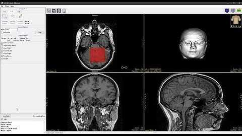 Analyze 14.0 - Measure: 2D Sample Rectangles