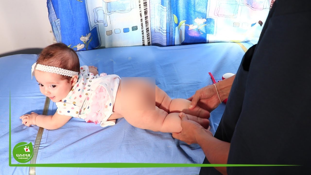 Բարուրելու վնասներ և կոնքազդրային հոդի դիսպլազիա - #Առողջնախագիծ