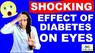 Shocking Effect Of Diabetes On Eye Cataract | Sorbitol Pathway In Diabetes | Daily MED
