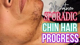 #Hirsutism SPORADIC Chin Hair Progress. Amazing Results!
