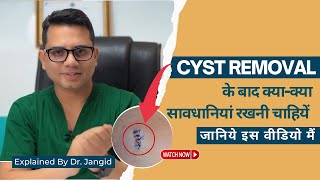 Care after Cyst removal | Cyst removal in Delhi | Cyst removal surgery | Dr Jangid  | SkinQure