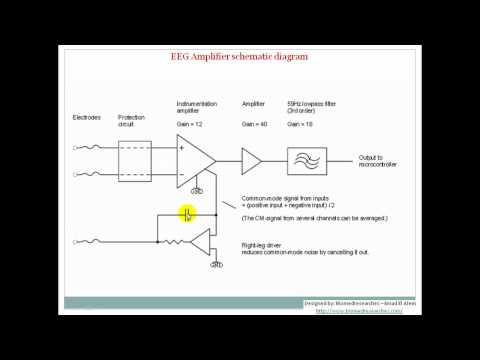 Understanding EEG Part8: EEG Localization and amplifiers, What is electroencephalography (EEG)?