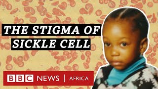 Sickle cell:  I didn't know I had the disease - BBC Africa