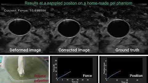 Deformation-Aware Robotic 3D Ultrasound