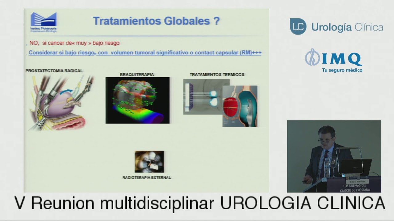 radioterapia curativa en cáncer de próstata