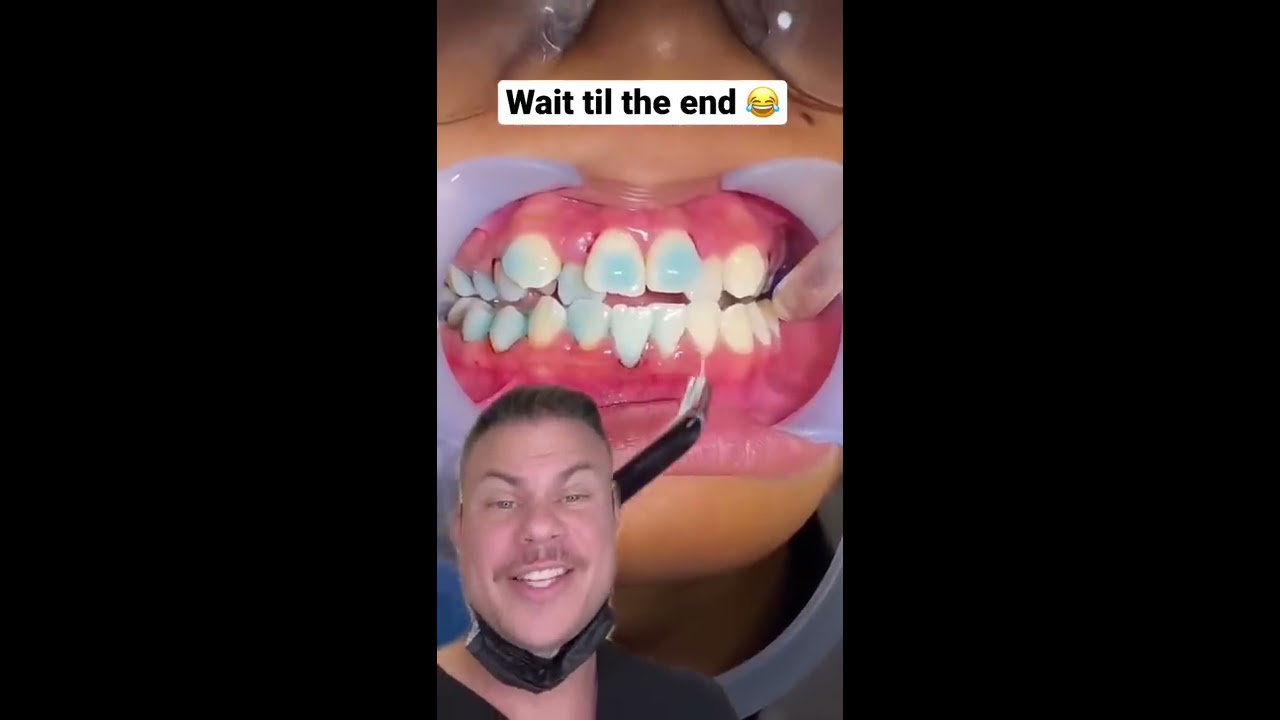 How Braces Are Put On