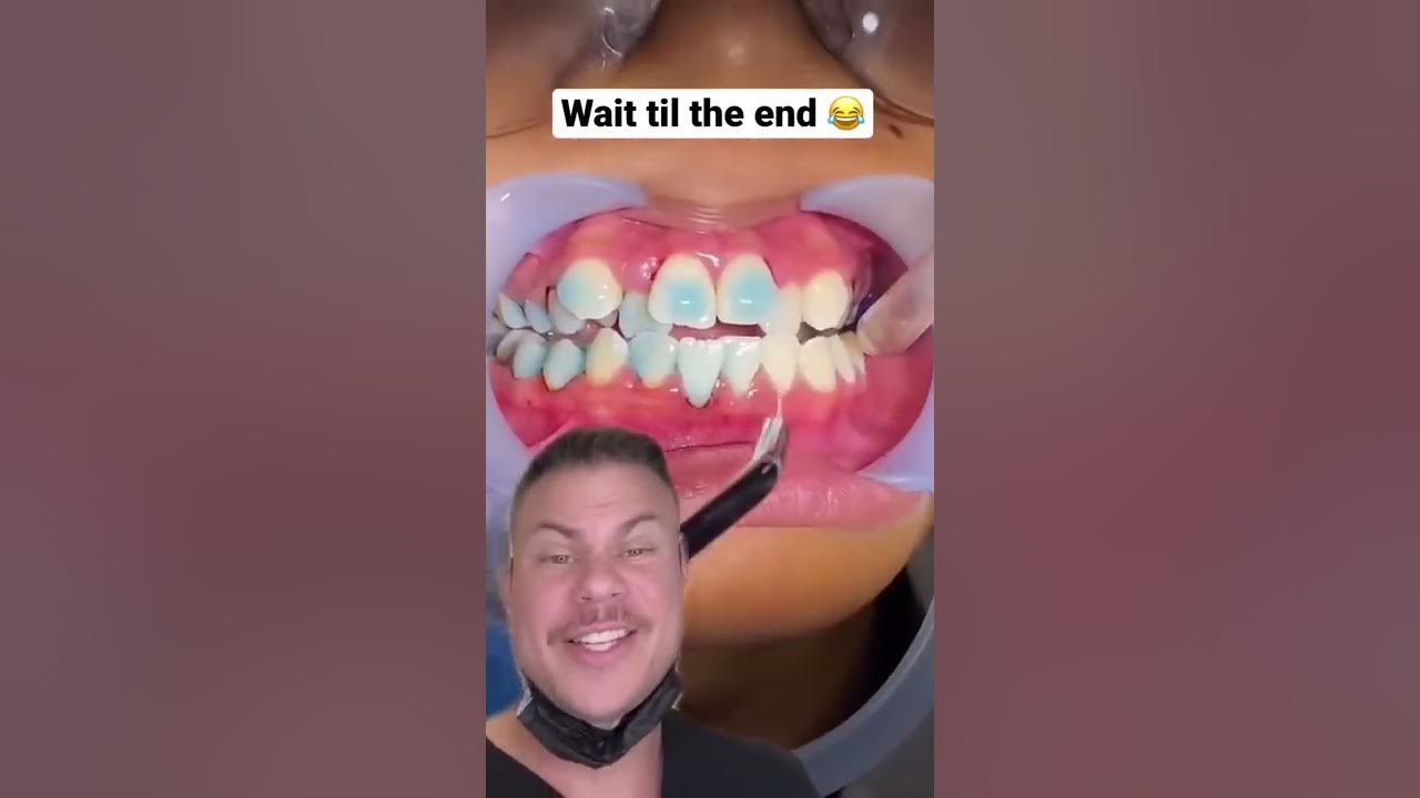 How Braces Are Put On