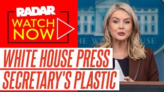 Karoline Leavitt's 'Visible Lip Injection Marks' Exposed... as White House Press Sec Sparks Plastic